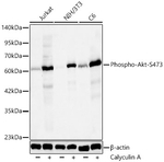 Phospho-AKT Pan (Ser473) Antibody in Western Blot (WB)