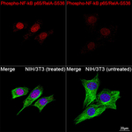Phospho-NFkB p65 (Ser536) Recombinant Rabbit Monoclonal Antibody (9Y6U8)