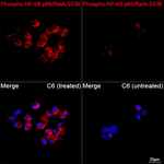 Phospho-NFkB p65 (Ser536) Antibody in Immunocytochemistry (ICC/IF)
