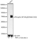 Phospho-NFkB p65 (Ser536) Antibody in Western Blot (WB)