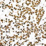 Phospho-TIFA (Thr9) Antibody in Immunohistochemistry (Paraffin) (IHC (P))