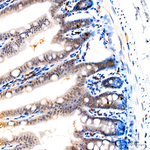 Phospho-Histone H3 (Thr11) Antibody in Immunohistochemistry (Paraffin) (IHC (P))