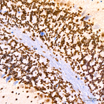 Phospho-Histone H3 (Thr11) Antibody in Immunohistochemistry (Paraffin) (IHC (P))
