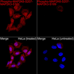 Phospho-MEK3/MEK6 (Ser189, Ser207) Recombinant Rabbit Monoclonal Antibody (1Z3S1)
