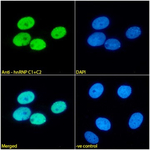 hnRNP C1/C2 Recombinant Mouse Monoclonal Antibody (4F4)
