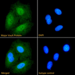 MVP Recombinant Mouse Monoclonal Antibody (1032)