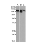 MVP Antibody in Western Blot (WB)