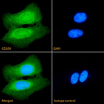 CD109 Recombinant Mouse Monoclonal Antibody (CBL 017 6856)