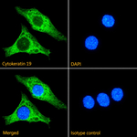 Cytokeratin 19 Recombinant Mouse Monoclonal Antibody (A53-B/A2)