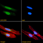 ICAM3 Recombinant Mouse Monoclonal Antibody (101-1D2)