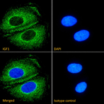 IGF1 Recombinant Rabbit Monoclonal Antibody (7973)