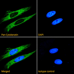 Pan Cytokeratin Recombinant Rabbit Monoclonal Antibody (C11)