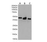Cytokeratin 18 Recombinant Rabbit Monoclonal Antibody (DA-7)