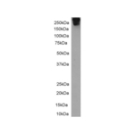 CD109 Antibody in Western Blot (WB)