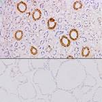 Thyroglobulin Antibody in Immunohistochemistry (Paraffin) (IHC (P))