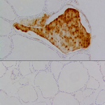 Thyroglobulin Recombinant Rabbit Monoclonal Antibody (2H11)