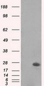 MAD2L1 Antibody in Western Blot (WB)