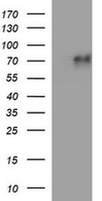 MADCAM1 Antibody in Western Blot (WB)
