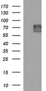 MADCAM1 Antibody in Western Blot (WB)