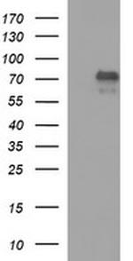 MADCAM1 Antibody in Western Blot (WB)