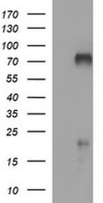 MADCAM1 Antibody in Western Blot (WB)