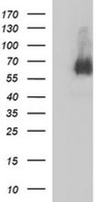 MADCAM1 Antibody in Western Blot (WB)