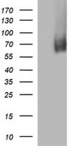 MADCAM1 Antibody in Western Blot (WB)