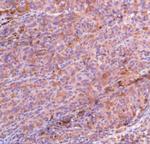 MAGE1 Antibody in Immunohistochemistry (IHC)
