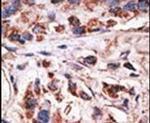 MAGE1 Antibody in Immunohistochemistry (IHC)