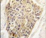 MAGE1 Antibody in Immunohistochemistry (IHC)