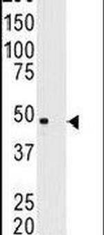 MAGEA11 Antibody in Western Blot (WB)