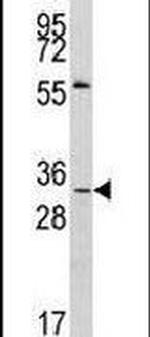 MAGE1 Antibody in Western Blot (WB)
