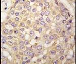 MAGEA4 Antibody in Immunohistochemistry (IHC)