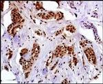 MAGEA4 Antibody in Immunohistochemistry (IHC)