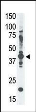MAGEA4 Antibody in Western Blot (WB)