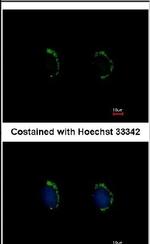 MAGEA8 Antibody in Immunocytochemistry (ICC/IF)