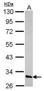 MAGEA8 Antibody in Western Blot (WB)