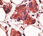 MAGEA9 Antibody in Immunohistochemistry (IHC)