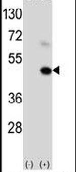 MAGEA9 Antibody in Western Blot (WB)