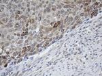 MAGEB1 Antibody in Immunohistochemistry (Paraffin) (IHC (P))