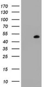 MAGEB1 Antibody in Western Blot (WB)
