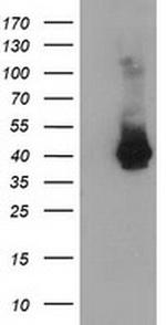 MAGEB18 Antibody in Western Blot (WB)