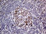 MAGEB4 Antibody in Immunohistochemistry (Paraffin) (IHC (P))