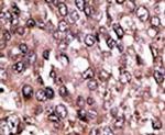MAGEC1 Antibody in Immunohistochemistry (IHC)