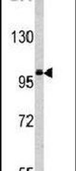 MAGEC1 Antibody in Western Blot (WB)
