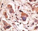 MAGED1 Antibody in Immunohistochemistry (IHC)
