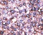 MAGED2 Antibody in Immunohistochemistry (IHC)