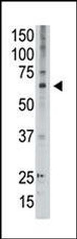 MAGED2 Antibody in Western Blot (WB)