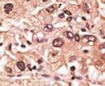 MAGEF1 Antibody in Immunohistochemistry (IHC)
