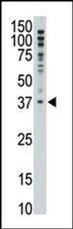 MAGEF1 Antibody in Western Blot (WB)